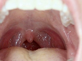 300人のおくち 第1集　サンプル画像07